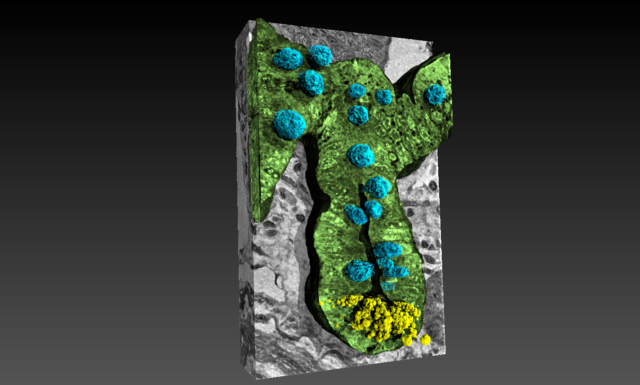 intestino cellule immunitarie alzheimer